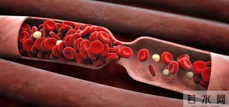 人不会无故患上冠心病？研究发现：患上冠心病，背后有4点原因