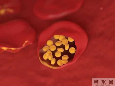 人不会无故患上冠心病？研究发现：患上冠心病，背后有4点原因