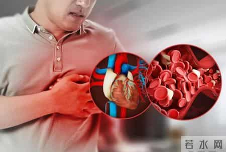 心梗死来临前，身体会发出8个“警报”，早发现早治疗