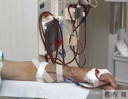尿毒症一半是喝死的？医生告诫：尿毒症不节制，3个后果很严重