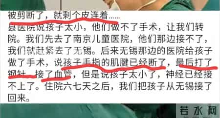心疼到哭！新生儿剪脐带被剪断手指，医院的回应我听不下去
