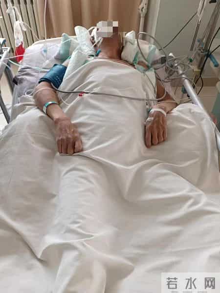 医生开错颅后续：患者没拿到300万赔偿，倒被医院告要160万医药费