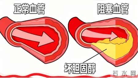 研究发现：不吃花生和鸡蛋的人，胆固醇马上就降低了？可信吗