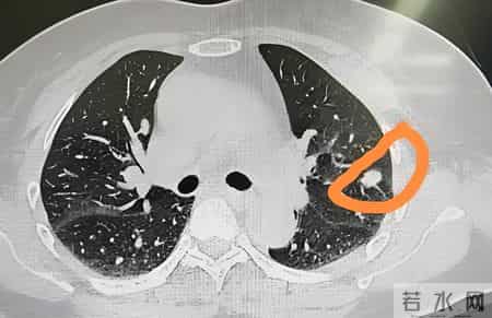 中药又立功？蒲公英可杀死98%癌细胞、消除结节？揭开研究真相