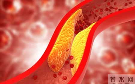 血压高和吃醋有关？医生提醒：年纪大的人，千万要注意这4件事