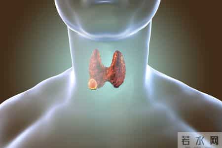 腊肉再次被关注！医生发现：甲状腺患者喜欢吃腊肉，要注意这4点