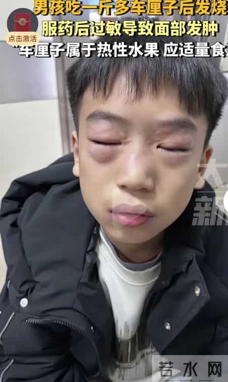 杭州娃吃15颗车厘子进医院！医生提醒-这种水果再爱吃也要控量