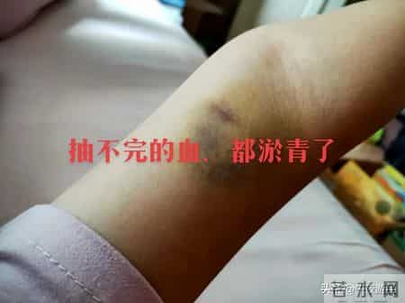 江西汤春香去世，年仅36岁，因肚子长包确诊，抗癌成功后再次复发