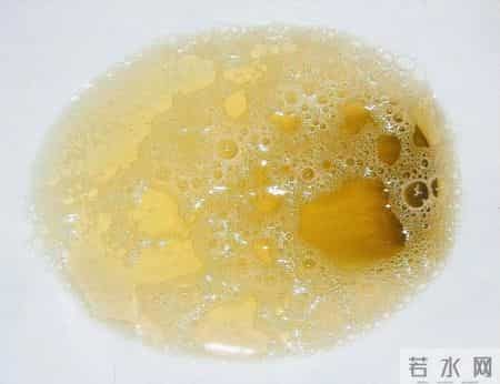 人有没有肾病，看喝水就知？医生：有肾病的人，喝水多会有5异常