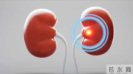 为何尿毒症越来越多？劝告：3物别贪嘴，肾会感激你！