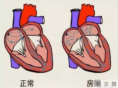 心律失常患者增多，医生发现：心脏出现问题，背后离不开3点
