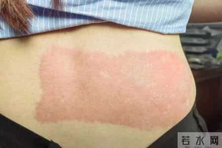 多名医生呼吁：立即停止使用电热毯，否则可能会诱发这些疾病？