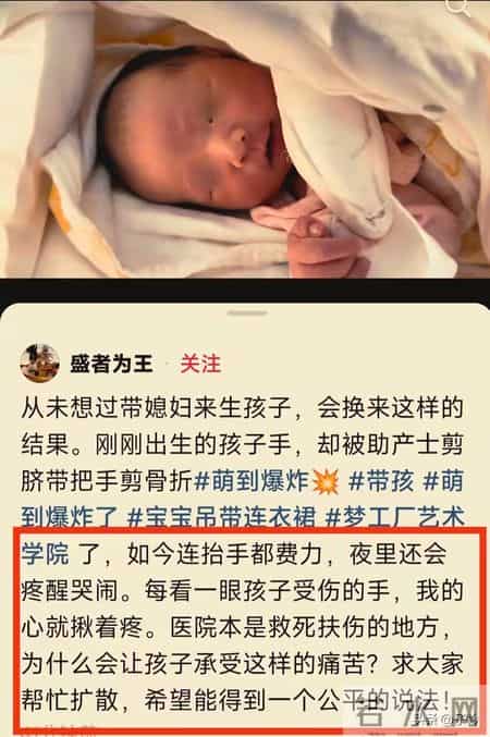 痛死了！新生儿被剪断手指紧急转院， 家属发声暂不谈赔偿太扎心