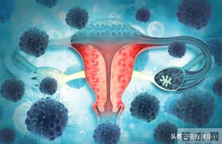 52岁大娘卵巢癌离世，医生呼吁5种习惯尽量改正，别再放纵自己了