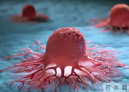 59岁男子大便次数增多没在意，三个月后因为癌王去世，很可惜