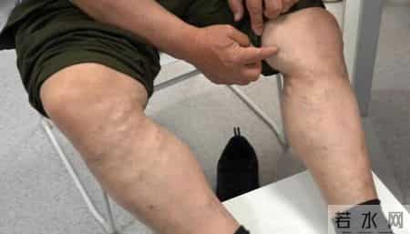 一手术人就垮了？医生直言：5种疾病无需动刀，别让无知害了自己