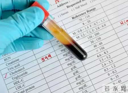 吃他汀，多长时间查一次血脂？医生：按照这个标准走就可以