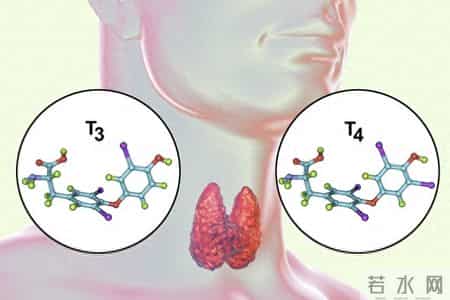 多名院士提醒：查出甲状腺结节多年没恶变，饮食中牢记这6个原则
