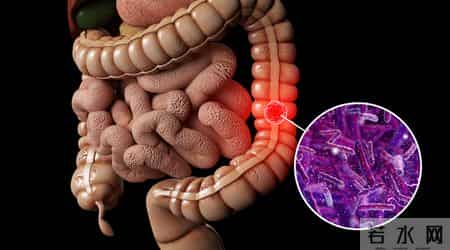 为啥很多人不愿意做肠镜？外国研究：做一次肠镜，或保十年安全？