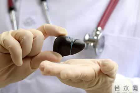 调查发现：65岁后常吃鸡蛋，患肝癌风险是不吃鸡蛋的数倍真的吗