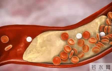 间隔一天吃他汀，降脂效果更好？医生提议：服用他汀，谨记这9点