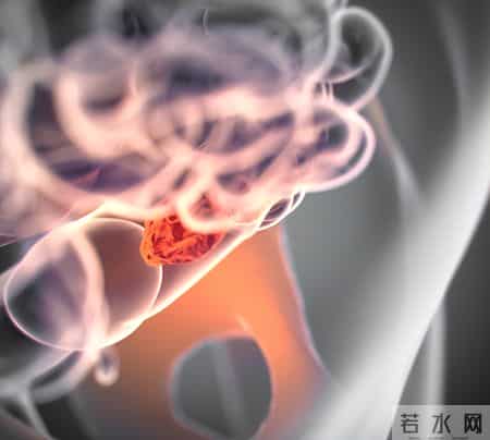 为啥很多人不愿意做肠镜？外国研究：做一次肠镜，或保十年安全？