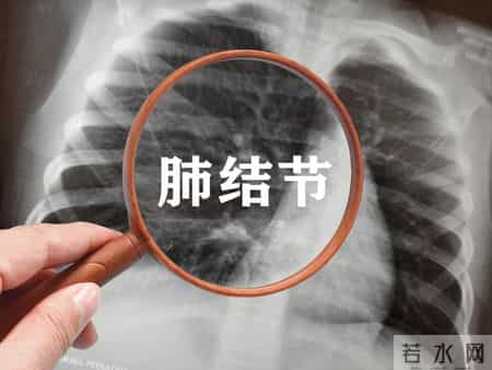 医生警告：一旦出现这3个症状，说明烟已伤身，必须马上戒！