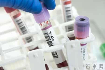 什么样的糖化血红蛋白最危险？专家：这5种异常，你了解吗