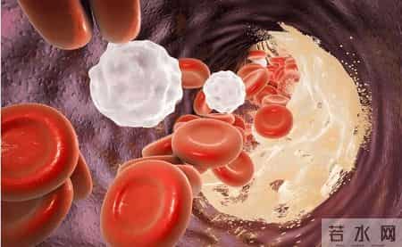 医生发现：不吃花生和鸡蛋的人，胆固醇马上就降低了？可信吗