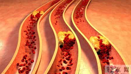 医生发现：高血脂患者若每天吃水煮蛋，不用多久，或会有7个改善