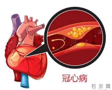 心律失常患者增多，医生发现：心脏出现问题，背后离不开3点