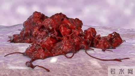 结直肠癌转移 5 危险信号！忠告：出现一个就就医，别耽误诊疗时机