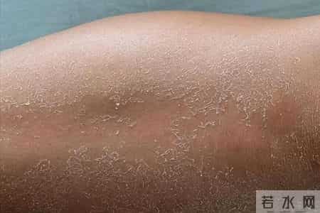 医生呼吁：快停止使用电热毯，否则会诱发疾病？真相在这