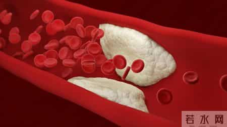 间隔一天吃他汀，降脂效果更好？医生建议：服用他汀，谨记这7点