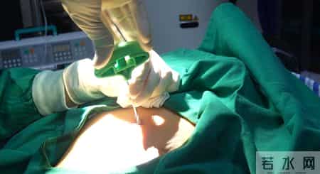 叫停无用治疗，中晚期肿瘤别硬扛！肿瘤医生给你指条实在路