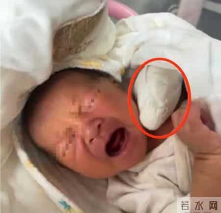 太离谱！新生儿手指被当脐带剪断，脸涨红，哭得撕心裂肺