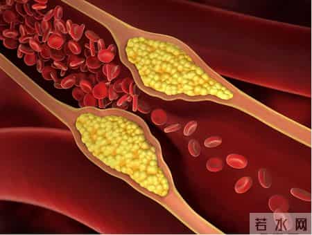 专家发现：高血压的人没有这些情况，可以松一口气了，问题不大