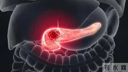 全球四分之一胰腺癌在我国，提醒：不想胰腺受伤，4种零食要少吃