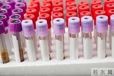 美国脂质学会【最新血脂标准】：所有人的“低密度”都应＜2.6！