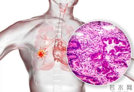 中药又立功？蒲公英可杀死98%癌细胞、消除结节？揭开研究真相