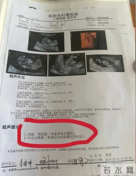 概率仅1300万分之一！辽宁孕妇产检一胎变同卵四胎：尚无异常，只是4个月胖20斤