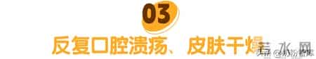 其实宝宝早就缺营养了！这4个“信号”千万别忽视！附自查表+对策