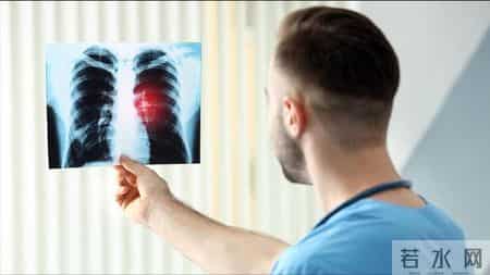 医生提醒：跟肺癌患者一起吃饭，一定要注意5件事，千万别忽视！