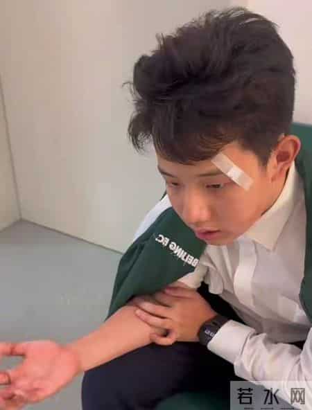 明星育儿“翻车”事件，挤痘痘真的会“要命”吗