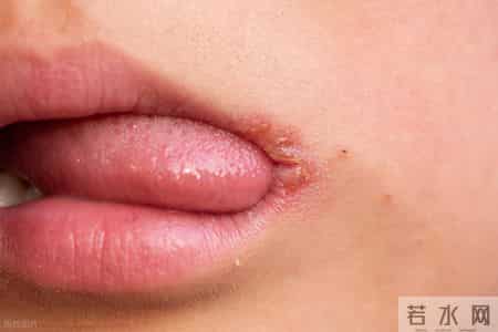 一滴也别喝！科学家发现，2020年全球有74万人因饮酒患癌