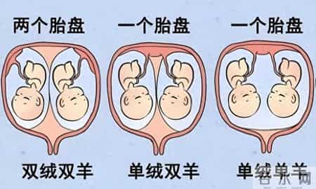 发生率不到万分之一 产科专家精准判断助罕见“单绒单羊”双胎分娩