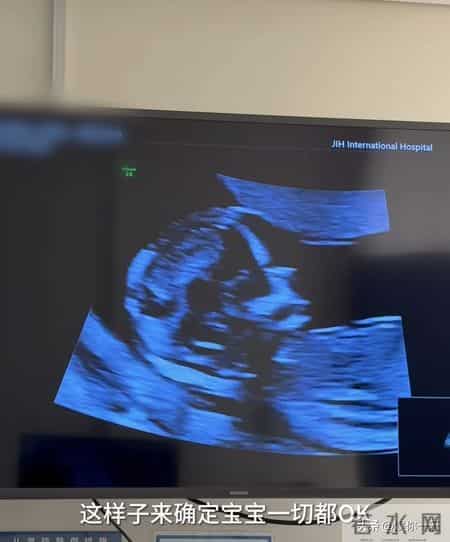 程晓玥透露二胎因吃药导致NT异常！羊水穿刺伤口令人心疼