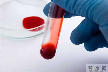 脑梗与戴帽子有关？医生再次提醒：过了60岁后，这4件事要多警惕