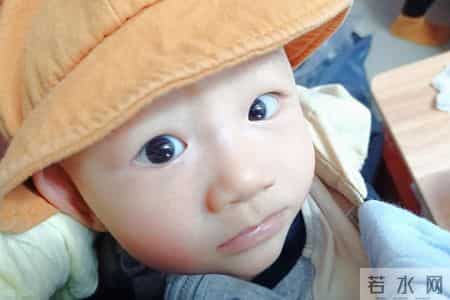 宝宝“斗鸡眼”？ 6个月是关键期，假性多能自愈，真性需早干预！