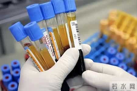 脑梗与戴帽子有关？医生再次提醒：过了60岁后，这4件事要多警惕